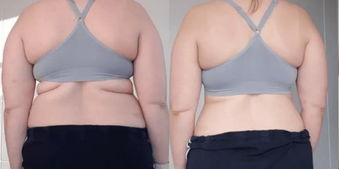 Female back view fat loss transformation after Andres Fitness online coaching